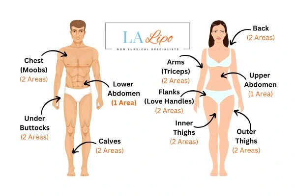 LA LIPO Cryolipolysis Areas Amersham