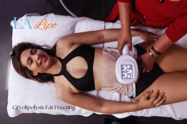 woman getting cryolipolysis Amersham