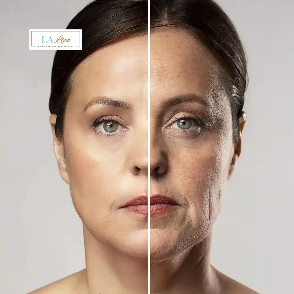 How Can You Tell If Non-Surgical Skin Tightening Is Right for You Amersham?