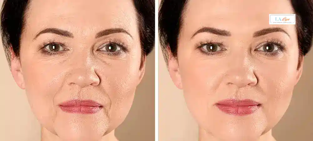 How Long Does It Take to See Results and How Long Do They Last Amersham?