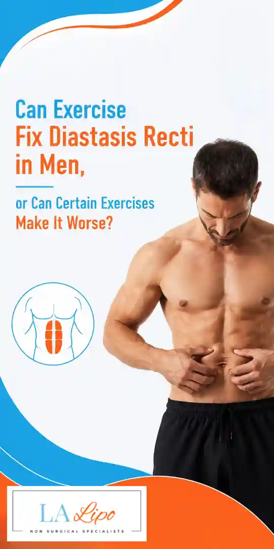 Can Exercise Fix Diastasis Recti in Men, or Can Certain Exercises Make It Worse Amersham?